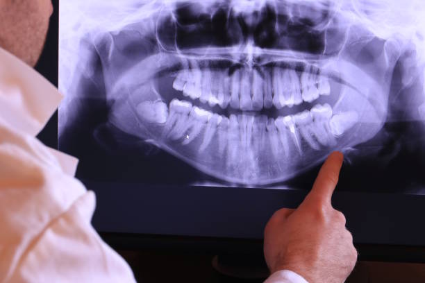 Best Emergency Root Canal Treatment in Chandler, AZ